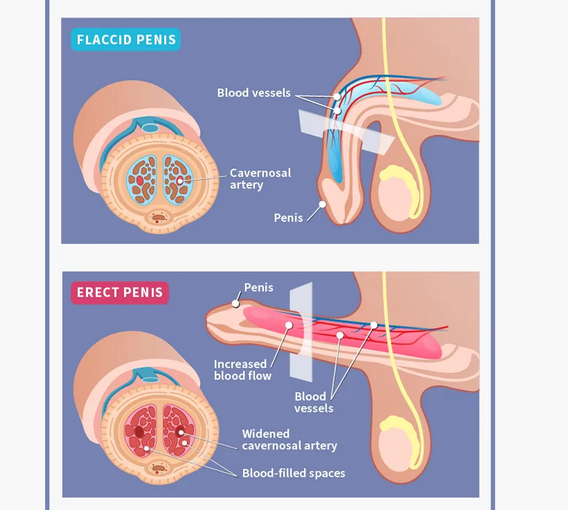 What are the Types of Erectile Dysfunction?